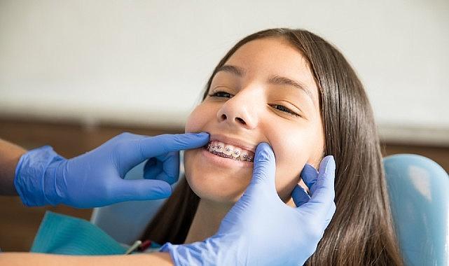 Ortodontik Tedaviler İçin 'Ergenlik' En İdeal Dönem
