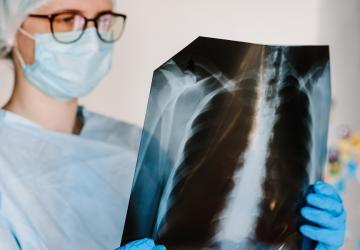 Kronik Obstrüktif Akciğer Hastalığı (KOAH) Nedir? Dünya KOAH Günü