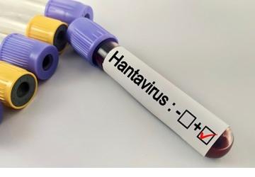 Hantavirüs Bir Salgına Dönüşür mü?